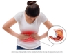 Phình Vị Dạ Dày và Một Số Bệnh Lý Thường Gặp