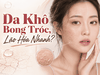 Da Khô Bong Tróc, Lão Hóa Nhanh? Cách Nhận Biết & Tuyệt Chiêu 
