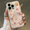 Ốp lưng Melody cute kèm giá gương_O141 (Iphone, Huawei, Honor, OPPO, Vivo, Xiaomi & Redmi)