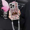 Ốp lưng chó Puppy kèm dây đeo_O04 (Iphone, Huawei, Honor, OPPO, Vivo, Xiaomi & Redmi)